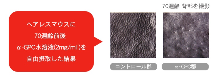 ミラグロAG