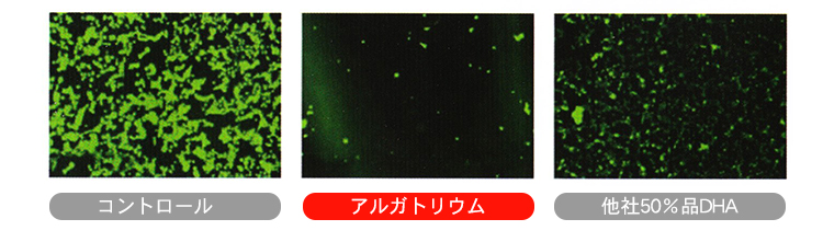 ミラグロAG